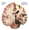 Dietary Fats and the Brain